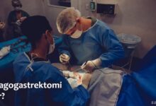 Özofagogastrektomi Nedir?