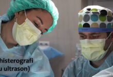 Sonohisterografi (Sulu Ultrason) Nedir?