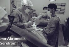 Oftalmo-Akromelik Sendrom Nedir?