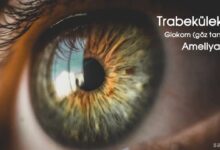 Trabekülektomi (Göz Tansiyonu Ameliyatı)