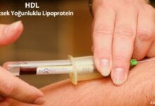Ailesel HDL Eksikliği Nedir?