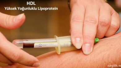 Ailesel HDL Eksikliği Nedir?