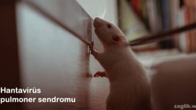 Hantavirüs Pulmoner Sendromu