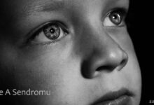 Triple A Sendromu Nedir?