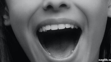 Ağız Tabanı Kanseri