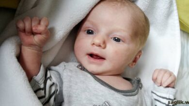 Bebek Sivilcesi (Aknesi)